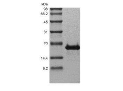 Novus Biologicals Recombinant Human TACI/TNFRSF13B/CVID Protein 1000 &mu;g | Buy Online | Novus Biologicals&trade; | Fisher Scientific