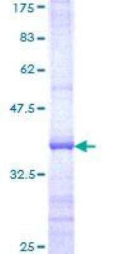 Novus Biologicals Recombinant Human TBL1 GST (N-Term) Protein 10 &mu;g | Buy Online | Novus Biologicals&trade; | Fisher Scientific