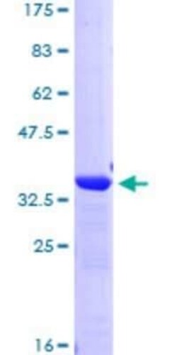 Novus Biologicals Recombinant Human TCF-2/HNF-1 beta GST (N-Term) Protein 25 &mu;g | Buy Online | Novus Biologicals&trade; | Fisher Scientific