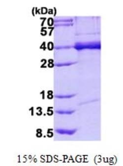 Novus Biologicals Recombinant Human TDP-43/TARDBP His Protein 0.02 mg | Buy Online | Novus Biologicals&trade; | Fisher Scientific