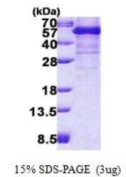 Novus Biologicals Recombinant Human TDP-43/TARDBP His Protein 0.1 mg | Buy Online | Novus Biologicals&trade; | Fisher Scientific