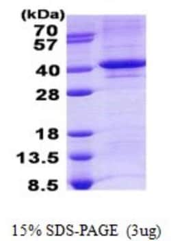 Novus Biologicals&trade;&nbsp;Recombinant Human TDP1 His Protein