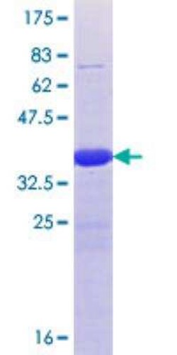 Novus Biologicals Recombinant Human TET1 GST (N-Term) Protein 25 &mu;g | Buy Online | Novus Biologicals&trade; | Fisher Scientific