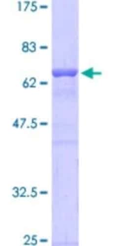 Novus Biologicals Recombinant Human TFII-I GST (N-Term) Protein 10 &mu;g | Buy Online | Novus Biologicals&trade; | Fisher Scientific