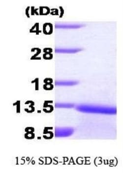 Novus Biologicals&trade;&nbsp;Recombinant Human TGF-beta 1 Protein