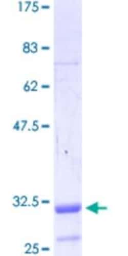 Novus Biologicals Recombinant Human TGF beta induced factor 2 GST (N-Term) Protein 10 &mu;g | Buy Online | Novus Biologicals&trade; | Fisher Scientific