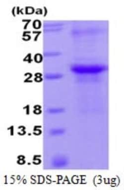 Novus Biologicals&trade;&nbsp;Recombinant Human TIMP-2 His Protein