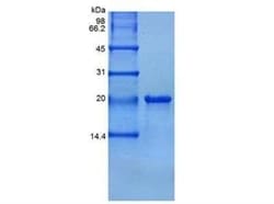 Novus Biologicals Recombinant Human TL1A/TNFSF15 Protein 500 &mu;g | Buy Online | Novus Biologicals&trade; | Fisher Scientific