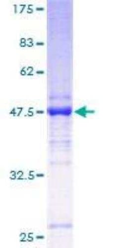 Novus Biologicals Recombinant Human TMED2 GST (N-Term) Protein 25 &mu;g | Buy Online | Novus Biologicals&trade; | Fisher Scientific