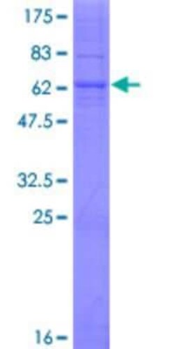 Novus Biologicals Recombinant Human TMEM231 GST (N-Term) Protein 10 &mu;g | Buy Online | Novus Biologicals&trade; | Fisher Scientific