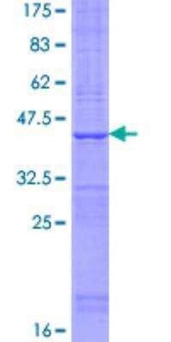Novus Biologicals Recombinant Human TMEM50B GST (N-Term) Protein 25 &mu;g | Buy Online | Novus Biologicals&trade; | Fisher Scientific