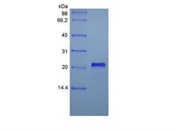 Novus Biologicals Recombinant Human TNF RI/TNFRSF1A Protein 100 &mu;g | Buy Online | Novus Biologicals&trade; | Fisher Scientific