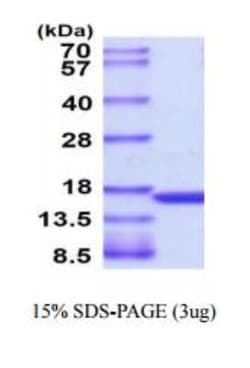 Novus Biologicals&trade;&nbsp;Recombinant Human TNF-alpha Protein