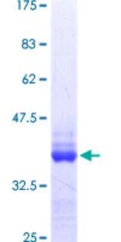 Novus Biologicals Recombinant Human TNRC6B GST (N-Term) Protein 10 &mu;g | Buy Online | Novus Biologicals&trade; | Fisher Scientific