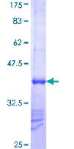 Novus Biologicals Recombinant Human TRIM23 GST (N-Term) Protein 25 &mu;g | Buy Online | Novus Biologicals&trade; | Fisher Scientific