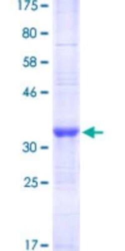 Novus Biologicals Recombinant Human TRIM49 GST (N-Term) Protein 10 &mu;g | Buy Online | Novus Biologicals&trade; | Fisher Scientific