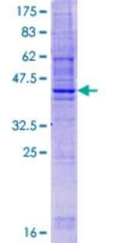 Novus Biologicals Recombinant Human TSPAN9 GST (N-Term) Protein 25 &mu;g | Buy Online | Novus Biologicals&trade; | Fisher Scientific