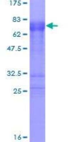 Novus Biologicals Recombinant Human TTP GST (N-Term) Protein 10 &mu;g | Buy Online | Novus Biologicals&trade; | Fisher Scientific