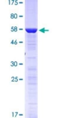 Novus Biologicals Recombinant Human Talin1 GST (N-Term) Protein 10 &mu;g | Buy Online | Novus Biologicals&trade; | Fisher Scientific