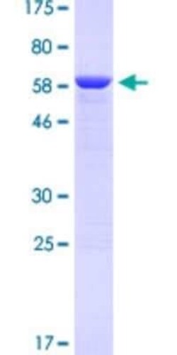 Novus Biologicals Recombinant Human Talin1 GST (N-Term) Protein 10 &mu;g | Buy Online | Novus Biologicals&trade; | Fisher Scientific