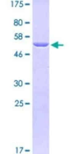 Novus Biologicals Recombinant Human Talin1 GST (N-Term) Protein 25 &mu;g | Buy Online | Novus Biologicals&trade; | Fisher Scientific