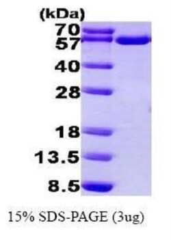 Novus Biologicals&trade;&nbsp;Recombinant Human Thioredoxin Reductase 1/TRXR1 His Protein