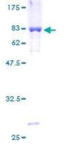 Novus Biologicals Recombinant Human Thromboxane synthase GST (N-Term) Protein 2 &mu;g | Buy Online | Novus Biologicals&trade; | Fisher Scientific