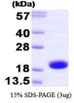 Novus Biologicals&trade;&nbsp;Recombinant Human TNNC2 Protein