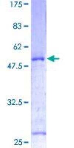 Novus Biologicals Recombinant Human Twist-1 GST (N-Term) Protein 2 &mu;g | Buy Online | Novus Biologicals&trade; | Fisher Scientific