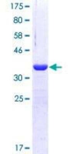 Novus Biologicals Recombinant Human Tyk2 GST (N-Term) Protein 10 &mu;g | Buy Online | Novus Biologicals&trade; | Fisher Scientific