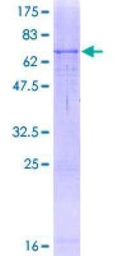 Novus Biologicals Recombinant Human Tyrosinase GST (N-Term) Protein 2 &mu;g | Buy Online | Novus Biologicals&trade; | Fisher Scientific