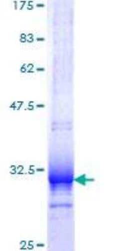 Novus Biologicals Recombinant Human UCP1 GST (N-Term) Protein 25 &mu;g | Buy Online | Novus Biologicals&trade; | Fisher Scientific