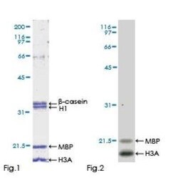 Novus Biologicals Recombinant Human ULK4 GST (N-Term) Protein 10 &mu;g | Buy Online | Novus Biologicals&trade; | Fisher Scientific
