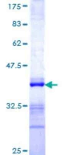 Novus Biologicals Recombinant Human UNKL GST (N-Term) Protein 25 &mu;g | Buy Online | Novus Biologicals&trade; | Fisher Scientific