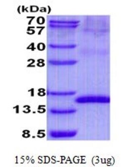 Novus Biologicals&trade;&nbsp;Recombinant Human Uroplakin II His Protein