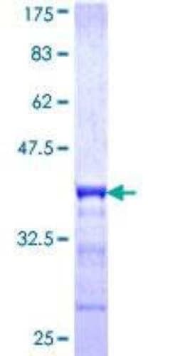 Novus Biologicals Recombinant Human Uroplakin Ib GST (N-Term) Protein 25 &mu;g | Buy Online | Novus Biologicals&trade; | Fisher Scientific