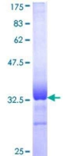 Novus Biologicals Recombinant Human V1a Vasopressin R/AVPR1A GST (N-Term) Protein 10 &mu;g | Buy Online | Novus Biologicals&trade; | Fisher Scientific