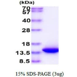 Novus Biologicals&trade;&nbsp;Recombinant Human VAMP-1 Protein