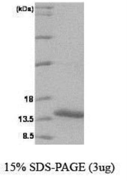 Novus Biologicals Recombinant Human VAMP-1 His Protein 0.1mg; Unlabeled | Buy Online | Novus Biologicals&trade; | Fisher Scientific