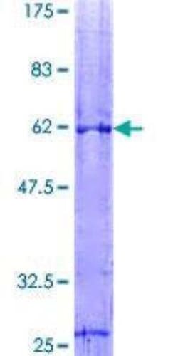 Novus Biologicals Recombinant Human VDAC1 GST (N-Term) Protein 10 &mu;g | Buy Online | Novus Biologicals&trade; | Fisher Scientific