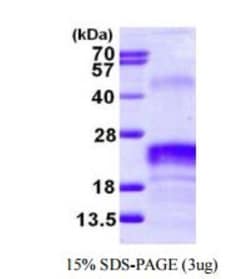 Novus Biologicals&trade;&nbsp;Recombinant Human VEGF 165 Protein