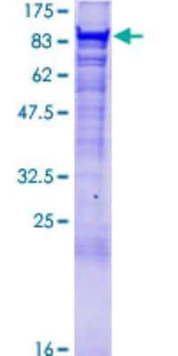 R&D Systems&trade;&nbsp;Recombinant Human VPS35 GST (N-Term) Protein