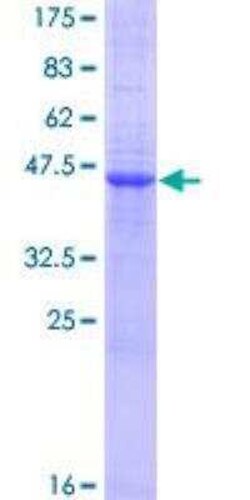 Novus Biologicals&trade;&nbsp;Recombinant Human VSTM1 GST (N-Term) Protein