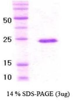 Novus Biologicals&trade;&nbsp;Recombinant Human Von Hippel Lindau His Protein