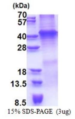 Novus Biologicals&trade;&nbsp;Recombinant Human Wnt-7a His Protein