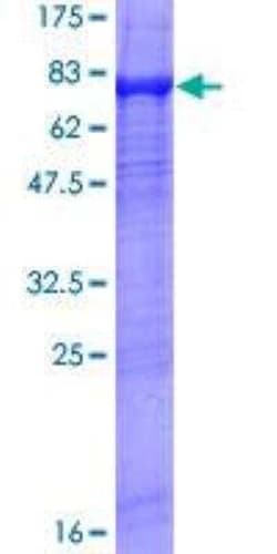 Novus Biologicals&trade;&nbsp;Recombinant Human Xrn1 GST (N-Term) Protein