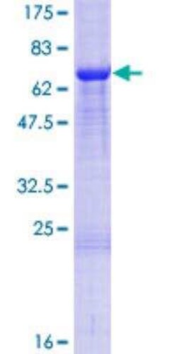 Novus Biologicals&trade;&nbsp;Recombinant Human YF5 GST (N-Term) Protein