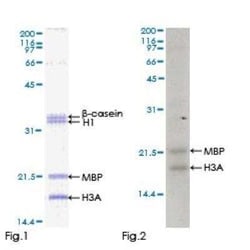 Novus Biologicals Recombinant Human ZAK GST (N-Term) Protein 25 &mu;g | Buy Online | Novus Biologicals&trade; | Fisher Scientific