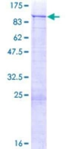 Novus Biologicals Recombinant Human ZNF254 GST (N-Term) Protein 10 &mu;g | Buy Online | Novus Biologicals&trade; | Fisher Scientific