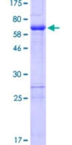Novus Biologicals Recombinant Human ZNF330 GST (N-Term) Protein 10 &mu;g | Buy Online | Novus Biologicals&trade; | Fisher Scientific